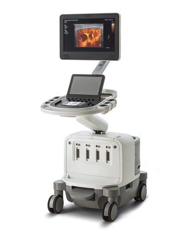 Phillips EPIQ 5 Ultrasound Machine